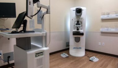 SmartCurve 3D Mammogram machine